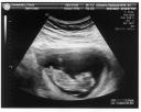 At 12 weeks: 5.5 cm [Ultrasound4.jpg]