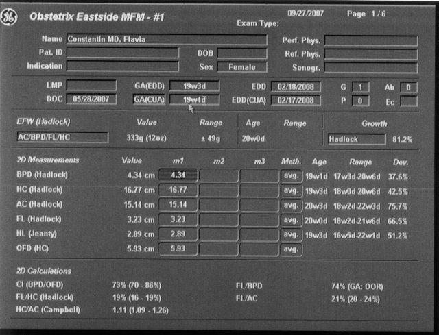 Estimated birthdate 2/17/2008 [Ultrasound16.jpg]